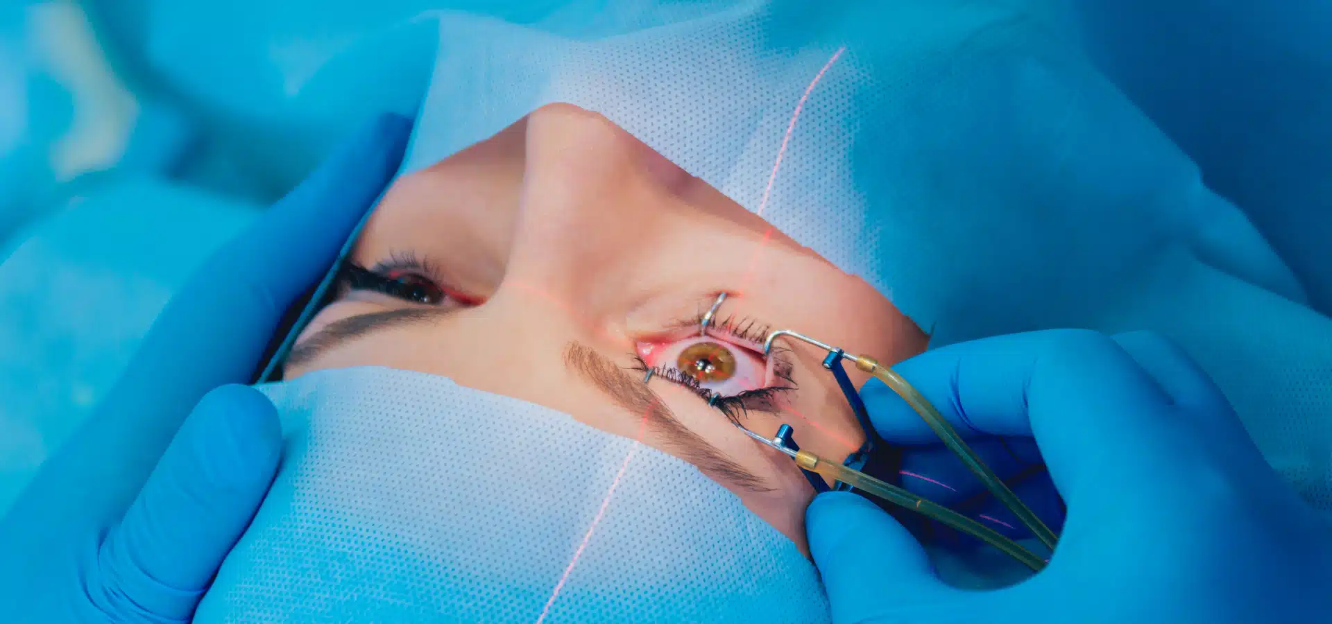 Moda o salud visual: lo que realmente significa la cirugía refractiva